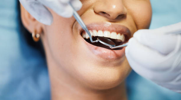 Best Same-Day Emergency Dental Services in St Stephens, NC