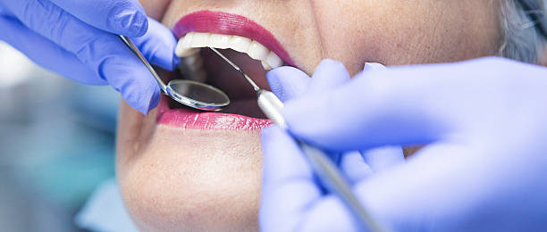 Best Emergency Dental Care for Broken or Chipped Teeth in St Stephens, NC